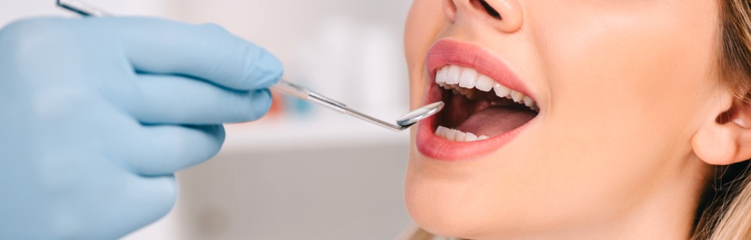 Восстановление зубов